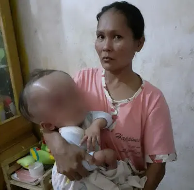 Penghasilan Tak Menentu, Keluarga Ini Kesulitan Biayai Berobat Anaknya